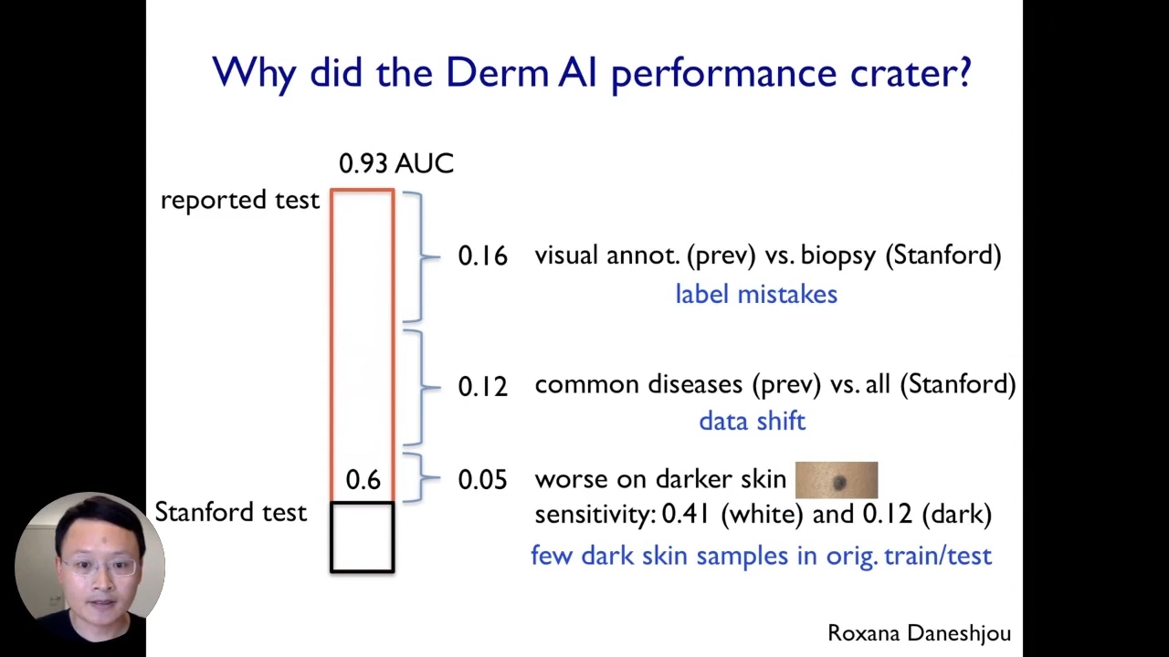 Interpretable AI: Why did the Derm AI performance crater?