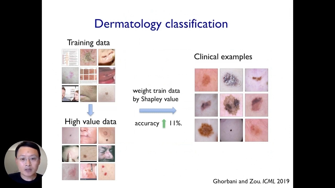 Interpretable AI: Dermatology classification